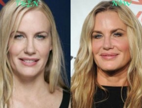 Daryl Hannah before and after plastic surgery 07
