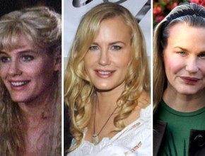 Daryl Hannah plastic surgery transformations