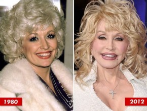 Dolly Parton before and after plastic surgery
