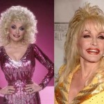 Dolly Parton before and after plastic surgery 02