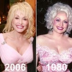 Dolly Parton before and after plastic surgery 05