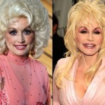 Dolly Parton before and after plastic surgery 08