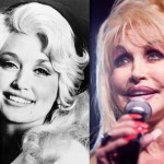 Dolly Parton before and after plastic surgery 10