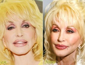 Dolly Parton then and now