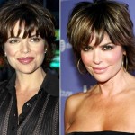 Lisa Rinna before and after plastic surgery 01