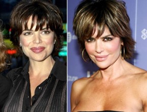 Lisa Rinna before and after plastic surgery 01