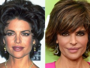 Lisa Rinna before and after plastic surgery