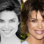 Lisa Rinna before and after plastic surgery 03