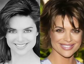 Lisa Rinna before and after plastic surgery 03