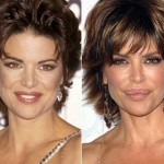 Lisa Rinna before and after plastic surgery 05