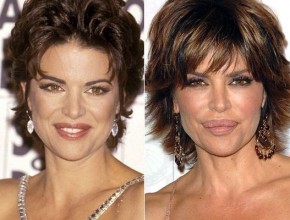 Lisa Rinna before and after plastic surgery 05