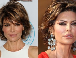 Lisa Rinna before and after plastic surgery 06