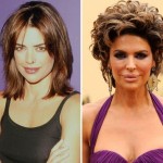 Lisa Rinna before and after plastic surgery 07