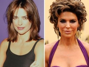 Lisa Rinna before and after plastic surgery 07