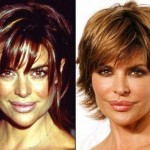 Lisa Rinna before and after using Botox
