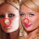 Paris Hilton before and after nose job