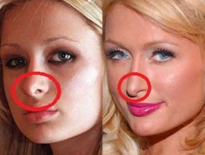 Paris Hilton before and after nose job