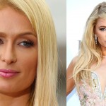 Paris Hilton before and after plastic surgery 01