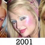 Paris Hiltonplastic surgery transformations