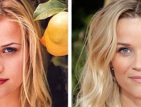 Reese Witherspoon before and after plastic surgery 01