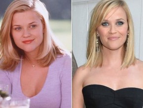 Reese Witherspoon before and after plastic surgery