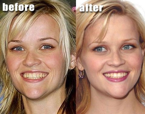 Celebrity plastic surgery online.