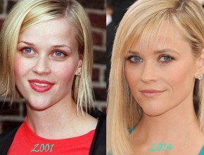 Reese Witherspoon before and after plastic surgery 06
