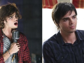 Reid Ewing before and after plastic surgery 02