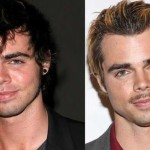 Reid Ewing before and after plastic surgery 03