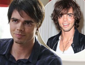 Reid Ewing before and after plastic surgery 04