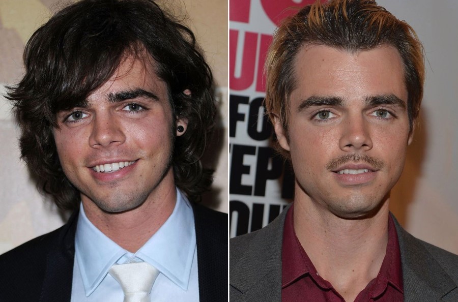 Reid Ewing before and after plastic surgery