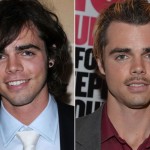 Reid Ewing before and after plastic surgery