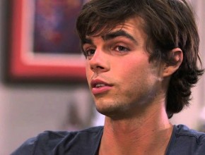 Reid Ewing plastic surgery 02