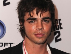 Reid Ewing plastic surgery 04