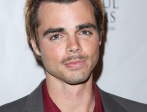 Reid Ewing plastic surgery 07