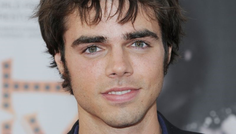 Reid Ewing plastic surgery