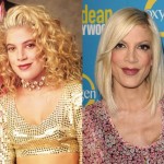 Tori Spelling before and after plastic surgery 03