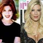 Tori Spelling before and after plastic surgery 04