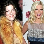 Tori Spelling before and after plastic surgery 05