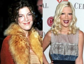Tori Spelling before and after plastic surgery 05