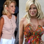 Tori Spelling before and after plastic surgery 07