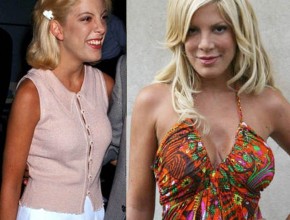 Tori Spelling before and after plastic surgery 07