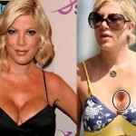 Tori Spelling before and after plastic surgery 08