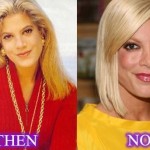 Tori Spelling before and after plastic surgery 09