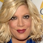 Tori Spelling botox plastic surgery