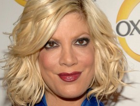 Tori Spelling botox plastic surgery