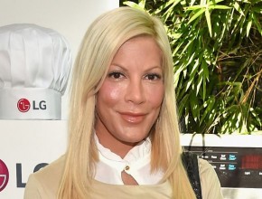 Tori Spelling plastic surgery 02