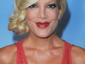 Tori Spelling plastic surgery 04