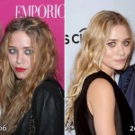 Ashley and Mary-Kate Olsen before and after plastic surgery 02