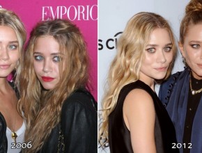 Ashley and Mary-Kate Olsen before and after plastic surgery 02